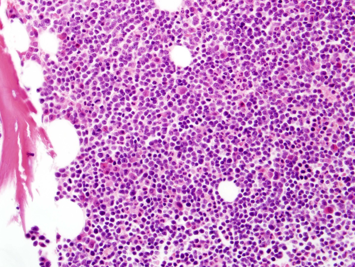 Biopsy core 400x
